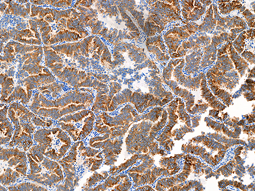ROS1 [EPMGHR2] 0.1ml