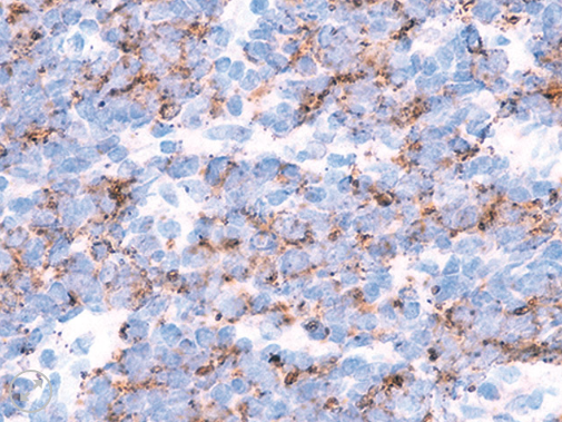 TIA-1 6ml - Ultraline